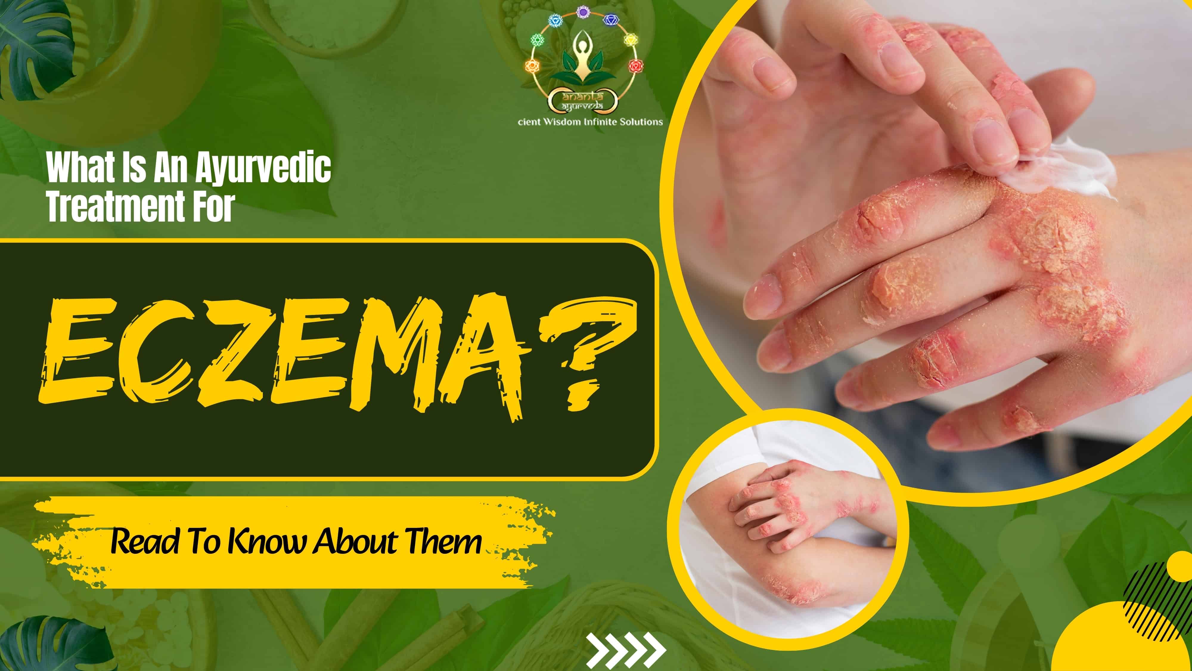 What Is An  Ayurvedic Treatment For Eczema? Read To Know About Them